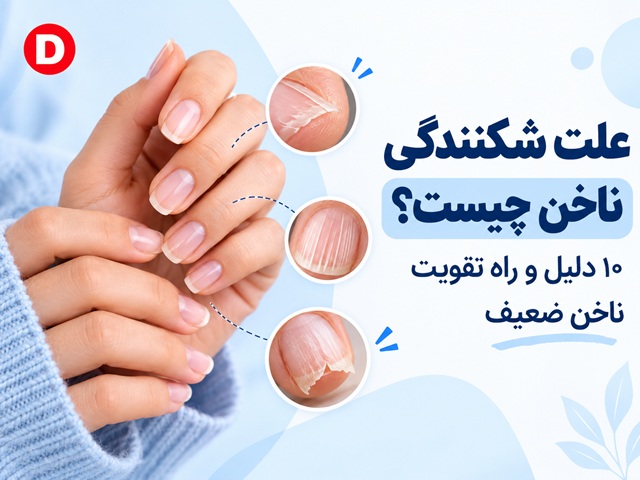 علت شکنندگی ناخن چیست؟ ۱۰ دلیل و راه تقویت ناخن ضعیف