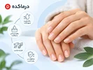 مراقبت از ناخن؛ ۱۵ راهکار برای داشتن ناخن‌های سالم و محکم