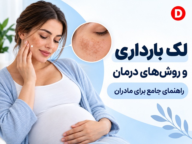 لک بارداری چیست؟ علت ملاسما و روش‌های ایمن درمان